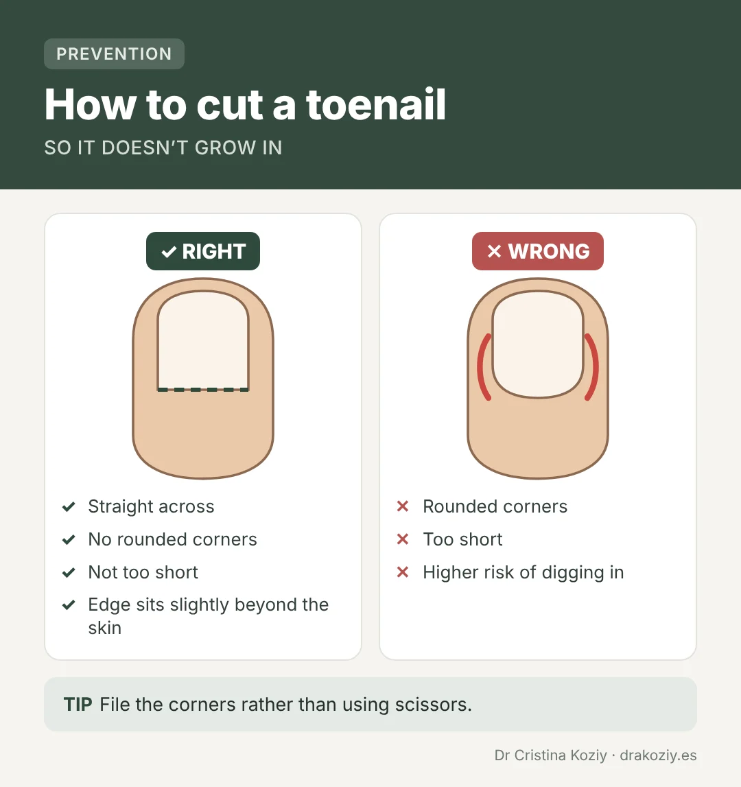 How to cut your toenail: straight across, without rounding the corners or cutting too short