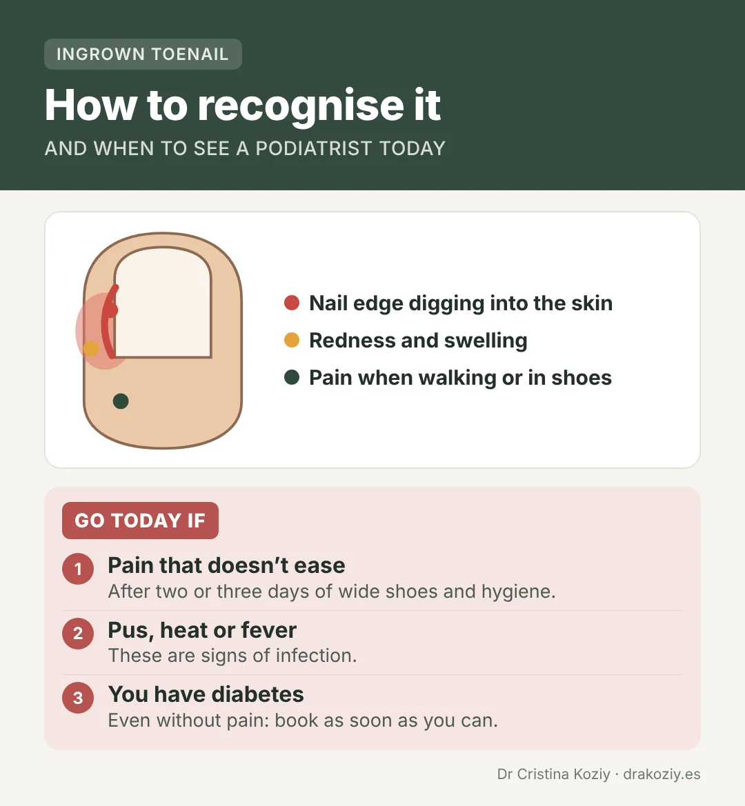 Ingrown toenail: signs to recognise it and when to see a podiatrist the same day