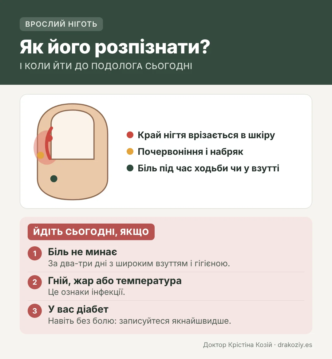 Врослий ніготь: ознаки і коли звернутися до подолога в той самий день